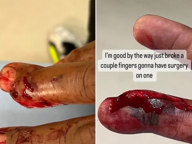 Celtics Legend Paul Pierce Shares Gruesome Photos of Finger Injury, Will Undergo Surgery